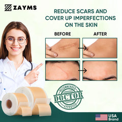 ZAYMS Silicone Scar Tape Roll (1.6” x 120”)