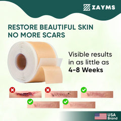 ZAYMS Silicone Scar Tape Roll (1.6” x 120”)