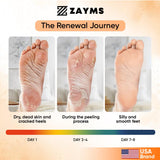 ZAYMS Foot Peel Mask 5 Pack