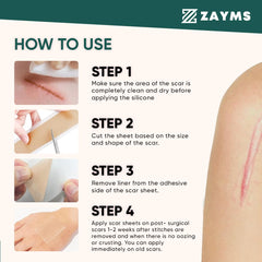 ZAYMS Silicone Scar Tape Roll (1.6” x 120”)