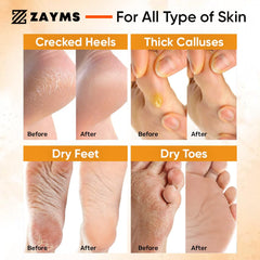 ZAYMS Foot Peel Mask 5 Pack