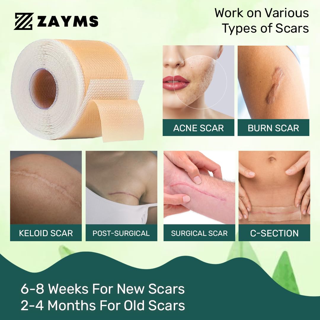 ZAYMS Silicone Scar Tape Roll (1.6” x 120”)
