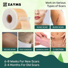 ZAYMS Silicone Scar Tape Roll (1.6” x 120”)