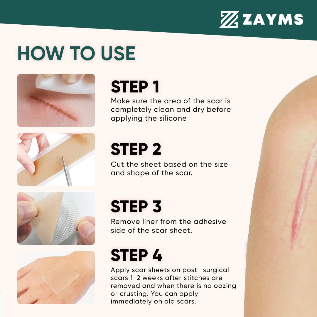 ZAYMS Silicone Scar Tape Roll (1.6” x 120”)