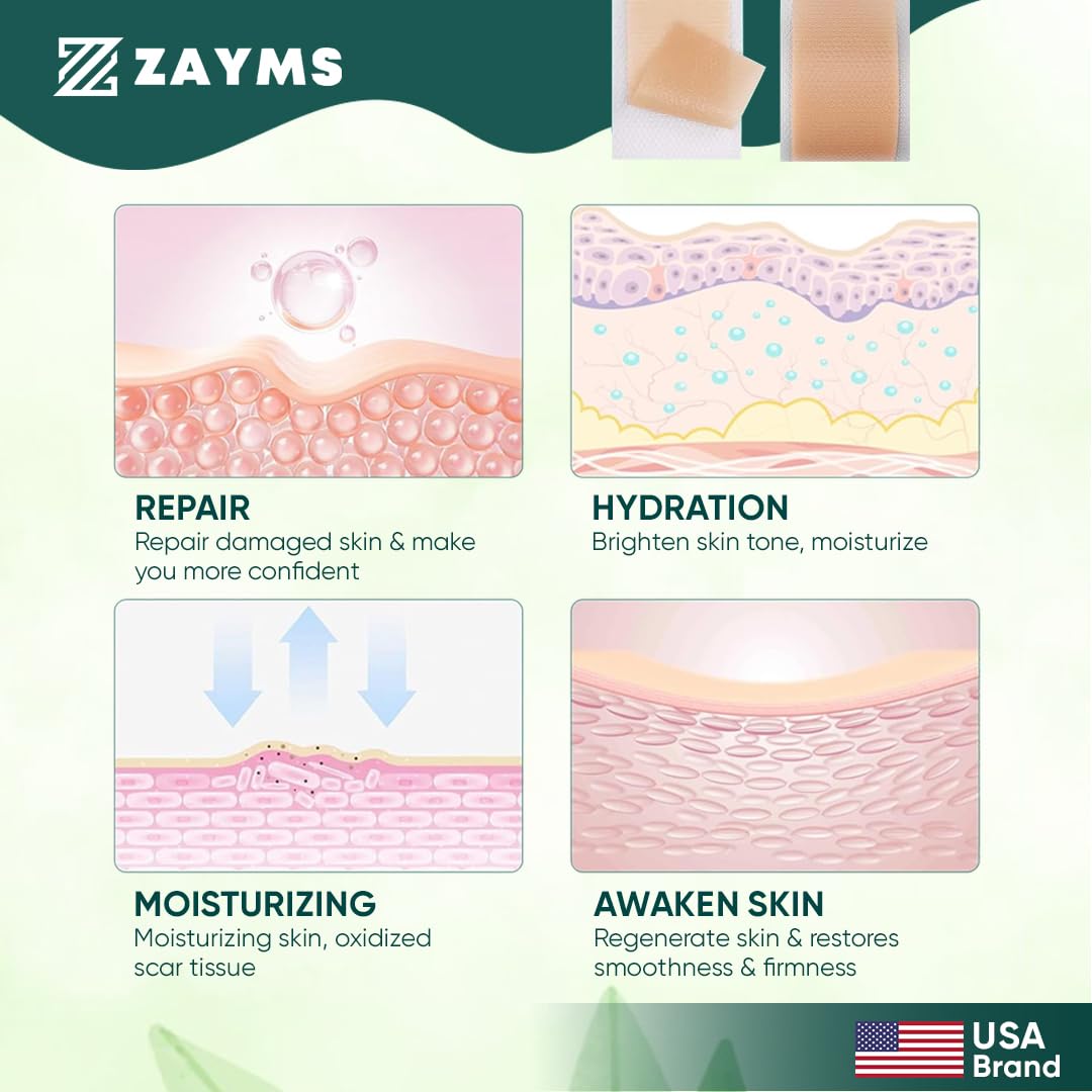 ZAYMS Silicone Scar Tape Roll (1.6” x 120”)